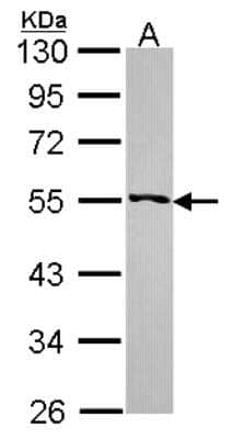 Western Blot: RRP1 Antibody [NBP2-20233] - Sample (30 ug of whole cell lysate) A: 293T 10% SDS PAGE gel, diluted at 1:1000.