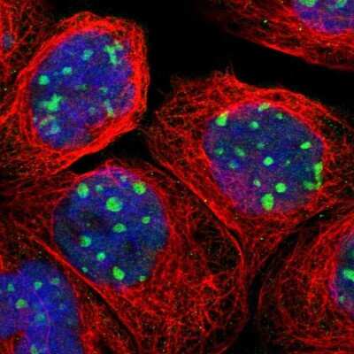 Immunocytochemistry/Immunofluorescence: RRP1B Antibody [NBP1-81534] - Immunofluorescent staining of human cell line A-431 shows localization to nucleoli. Antibody staining shown in green.