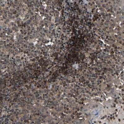 Immunohistochemistry-Paraffin: RRP1B Antibody [NBP1-81533] - Staining of human tonsil shows moderate to strong nuclear positivity in non-germinal center cells.