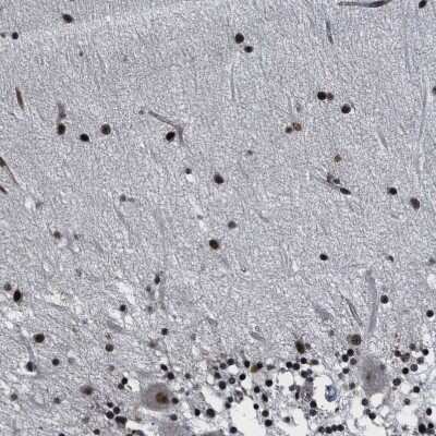 Immunohistochemistry-Paraffin: RRP1B Antibody [NBP1-81534] - Staining of human cerebellum shows strong nuclear positivity in cells in molecular layer.