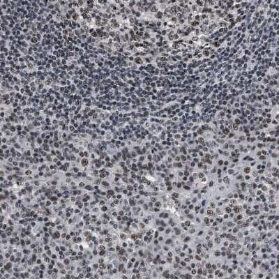 Immunohistochemistry-Paraffin: RRP1B Antibody [NBP1-81534] - Staining of human tonsil shows moderate to strong nuclear positivity in non-germinal center cells.