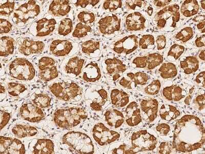 Immunohistochemistry-Paraffin: RRP36 Antibody [NBP2-98183] - Immunochemical staining of human RRP36 in human stomach with rabbit polyclonal antibody at 1:100 dilution, formalin-fixed paraffin embedded sections.
