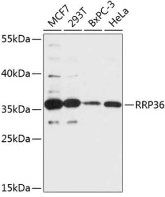 Western Blot: RRP36 Antibody [NBP2-93274] - Analysis of extracts of various cell lines, using RRP36 at 1:3000 dilution. Secondary antibody: HRP Goat Anti-Rabbit IgG (H+L) at 1:10000 dilution. Lysates/proteins: 25ug per lane. Blocking buffer: 3% nonfat dry milk in TBST. Detection: ECL Basic Kit . Exposure time: 90s.