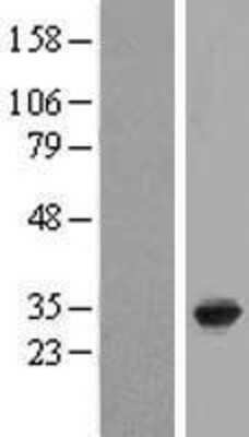 Western Blot: RRP36 Overexpression Lysate (Adult Normal) [NBL1-08517] Left-Empty vector transfected control cell lysate (HEK293 cell lysate); Right -Over-expression Lysate for RRP36.