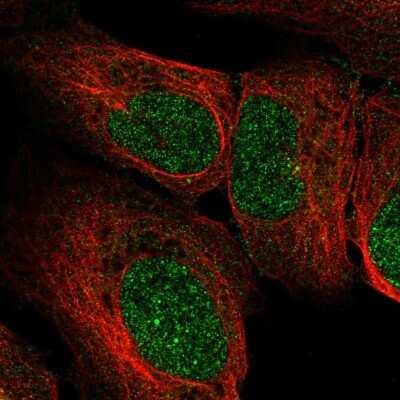 Immunocytochemistry/Immunofluorescence: RRP4 Antibody [NBP2-58481] - Staining of human cell line U-2 OS shows localization to nucleus.