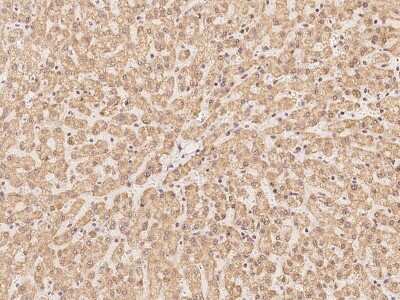 Immunohistochemistry-Paraffin: RRP4 Antibody [NBP2-97759] - Immunochemical staining of human RRP4 in human liver with rabbit polyclonal antibody at 1:100 dilution, formalin-fixed paraffin embedded sections.