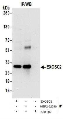 Immunoprecipitation: RRP4 Antibody [NBP2-22240] - Whole cell lysate (1 mg for IP; 20% of IP loaded) from 293T cells.  Antibodies: NBP2-22240 used for IP at 6 ug/mg lysate.  EXOSC2 was also immunoprecipitated by rabbit anti-EXOSC2 antibody.  For blotting immunoprecipitated EXOSC2, NBP2-22240 was used at 0.4 ug/ml.  Detection: Chemiluminescence with an exposure time of 30 seconds.