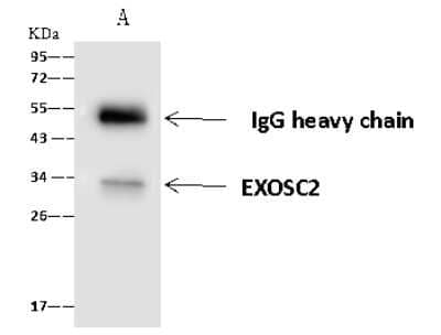 Immunoprecipitation: RRP4 Antibody [NBP2-97759] - RRP4 was immunoprecipitated using: Lane A: 0.5 mg Jurkat Whole Cell Lysate 4 ul anti-RRP4 rabbit polyclonal antibody and 60 ug of Immunomagnetic beads Protein A/G.  Primary antibody: Anti-RRP4 rabbit polyclonal antibody, at 1:100 dilution. Secondary antibody: Goat Anti-Rabbit IgG (H+L)/HRP at 1/10000 dilution. Developed using the ECL technique. Performed under reducing conditions. Predicted band size: 33 kDa. Observed band size: 33 kDa