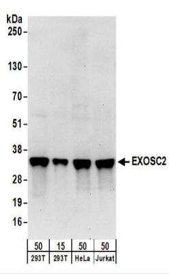 <b>Biological Strategies Validation. </b>Western Blot: RRP4 Antibody [NBP2-22240] - Whole cell lysate from 293T (15 and 50 ug), HeLa (50 ug), and Jurkat (50 ug) cells.  NBP2-22240 used for WB at 0.4 ug/ml.  Detection: Chemiluminescence with an exposure time of 30 seconds.