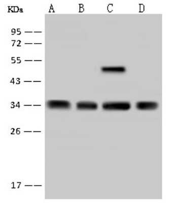 Western Blot: RRP4 Antibody [NBP2-97759] - Anti-RRP4 rabbit polyclonal antibody at 1:500 dilution. Lane A: 293T Whole Cell Lysate Lane B: Hela Whole Cell Lysate Lane C: Jurkat Whole Cell Lysate Lysates/proteins at 30 ug per lane. Secondary Goat Anti-Rabbit IgG (H+L)/HRP at 1/10000 dilution. Developed using the ECL technique. Performed under reducing conditions. Predicted band size: 33 kDa. Observed band size: 33 kDa