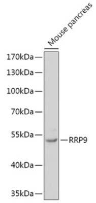 Western Blot: RRP9 Antibody [NBP2-94262] - Analysis of extracts of Mouse pancreas, using RRP9 at 1:1000 dilution.Secondary antibody: HRP Goat Anti-Rabbit IgG (H+L) at 1:10000 dilution.Lysates/proteins: 25ug per lane.Blocking buffer: 3% nonfat dry milk in TBST.Detection: ECL Basic Kit .Exposure time: 90s.