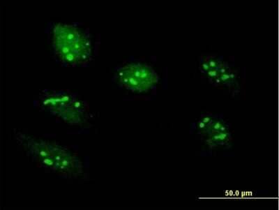 Immunocytochemistry/Immunofluorescence: RRS1 Antibody [H00023212-B02P] - Analysis of purified antibody to RRS1 on HeLa cell. (antibody concentration 10 ug/ml)