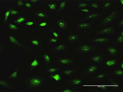 Immunocytochemistry/Immunofluorescence: RRS1 Antibody [H00023212-D01P] - Analysis of antibody to RRS1 on HeLa cell. Antibody concentration 10 ug/ml.