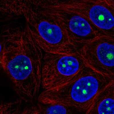 <b>Independent Antibodies Validation. </b>Immunocytochemistry/Immunofluorescence: RRS1 Antibody [NBP2-49323] - Staining of human cell line MCF7 shows localization to nucleoli. Antibody staining is shown in green.