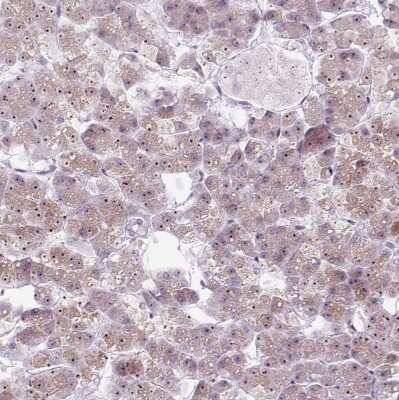 Immunohistochemistry-Paraffin: RRS1 Antibody [NBP2-30725] - Staining of human pancreas shows moderate to strong positivity in nucleoli in exocrine glandular cells.