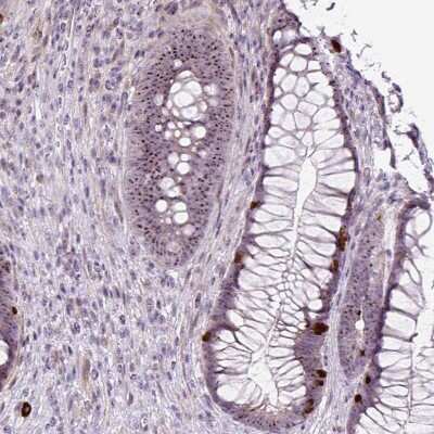 Immunohistochemistry-Paraffin: RRS1 Antibody [NBP2-30725] - Staining of human rectum shows strong positivity in nucleoli in glandular cells.