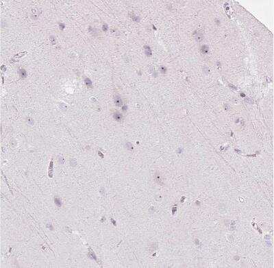 Immunohistochemistry-Paraffin: RRS1 Antibody [NBP2-30725] - Staining of human cerebral cortex shows moderate to strong positivity in nucleoli in a subset of neurons.