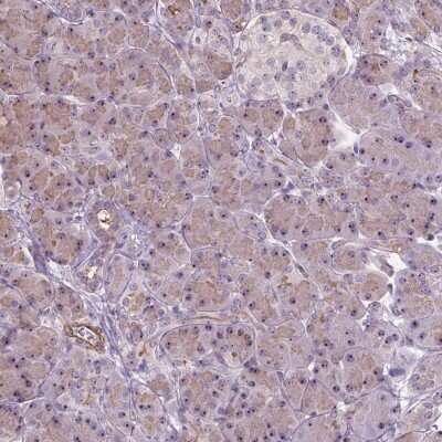 Immunohistochemistry-Paraffin: RRS1 Antibody [NBP2-49323] - Staining of human pancreas shows moderate nucleolar positivity in exocrine glandular cells.
