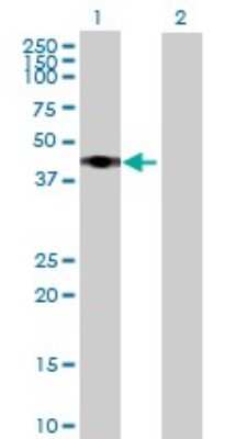 Western Blot RRS1 Antibody - Azide and BSA Free