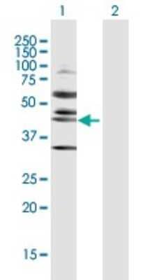 Western Blot: RRS1 Antibody [H00023212-D01P] - Analysis of RRS1 expression in transfected 293T cell line by RRS1 polyclonal antibody.Lane 1: RRS1 transfected lysate(41.20 KDa).Lane 2: Non-transfected lysate.