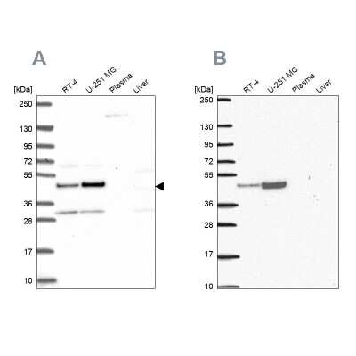 Western Blot RRS1 Antibody - BSA Free