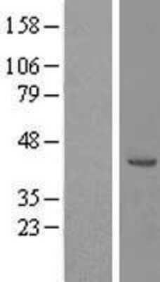 Western Blot RRS1 Overexpression Lysate