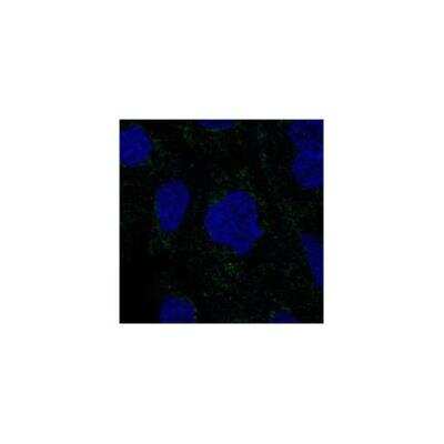 Immunocytochemistry/Immunofluorescence: RSAD1 Antibody [NBP3-17433] - Staining of human cell line EFO-21 shows localization to mitotic chromosome & mitochondria.