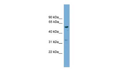 Western Blot: RSAD1 Antibody [NBP2-85677] - WB Suggested Anti-RSAD1 Antibody Titration: 0.2-1 ug/ml. ELISA Titer: 1:1562500. Positive Control: 293T cell lysateRSAD1 is supported by BioGPS gene expression data to be expressed in HEK293T