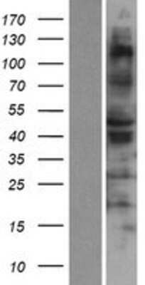 Western Blot: RSAD1 Overexpression Lysate (Adult Normal) [NBP2-06814] Left-Empty vector transfected control cell lysate (HEK293 cell lysate); Right -Over-expression Lysate for RSAD1.