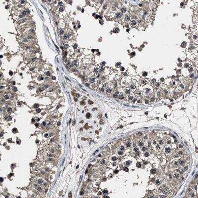 Immunohistochemistry RSBN1L Antibody - BSA Free
