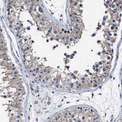 Immunohistochemistry: RSBN1L Antibody [NBP1-81903] - Staining of human testis shows cytoplasmic positivity in cells in seminiferous ducts.