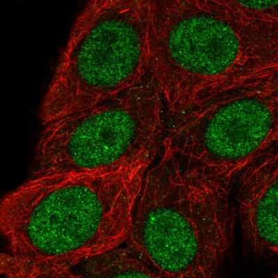 Immunocytochemistry/Immunofluorescence: RSF1 Antibody [NBP2-54961] - Staining of human cell line MCF7 shows localization to nucleoplasm.