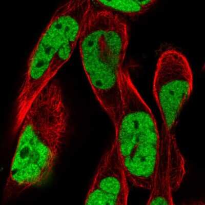 Immunocytochemistry/Immunofluorescence: RSF1 Antibody [NBP2-56940] - Staining of human cell line RH-30 shows localization to nucleoplasm.