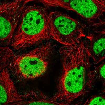 Immunocytochemistry/Immunofluorescence: RSF1 Antibody [NBP2-57248] - Staining of human cell line CACO-2 shows localization to nucleoplasm.