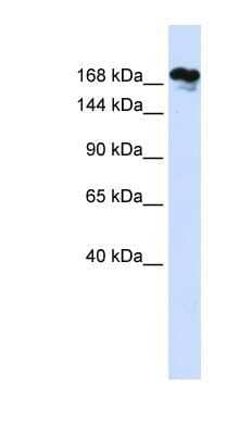 Western Blot: RSF1 Antibody [NBP1-52999] - Human Lung lysate, concentration 0.2-1 ug/ml.