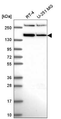 Western Blot RSF1 Antibody