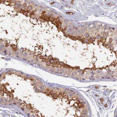 Immunohistochemistry-Paraffin: RSHL1 Antibody [NBP1-92356] - Staining of human testis shows strong cytoplasmic positivity in subset of cells in seminiferus ducts.