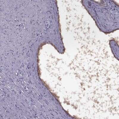 Immunohistochemistry-Paraffin RSHL1 Antibody