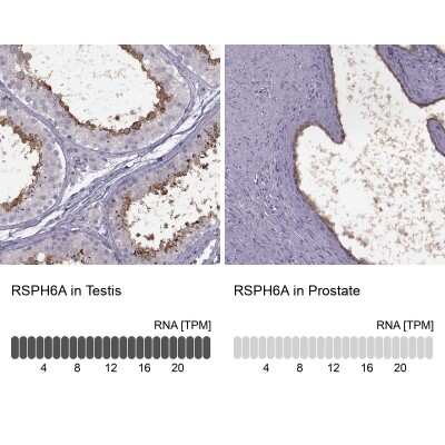 Immunohistochemistry-Paraffin RSHL1 Antibody