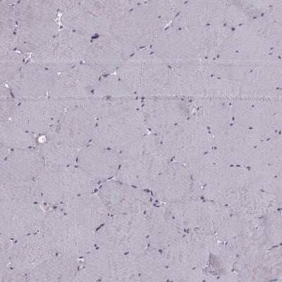 Immunohistochemistry-Paraffin RSHL1 Antibody