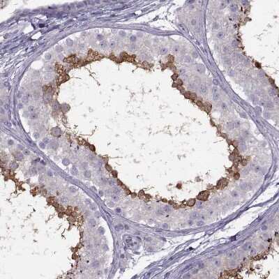 Immunohistochemistry-Paraffin: RSHL1 Antibody [NBP1-92356] - Staining of human testis shows moderate positivity in spermatocytes.