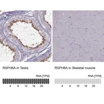 Immunohistochemistry-Paraffin: RSHL1 Antibody [NBP1-92356] - Staining in human testis and skeletal muscle tissues.. Corresponding RSPH6A RNA-seq data are presented for the same tissues.