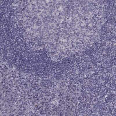 Immunohistochemistry-Paraffin: RSHL1 Antibody [NBP1-92356] - Staining of human tonsil shows no positivity in non-germinal center cells as expected.