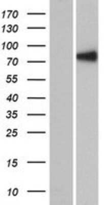 Western Blot: RSHL1 Overexpression Lysate (Adult Normal) [NBP2-06184] Left-Empty vector transfected control cell lysate (HEK293 cell lysate); Right -Over-expression Lysate for RSHL1.