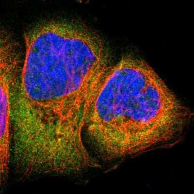 Immunocytochemistry/Immunofluorescence: RSK1 Antibody [NBP1-89647] - Immunofluorescent staining of human cell line A-431 shows localization to cytosol.