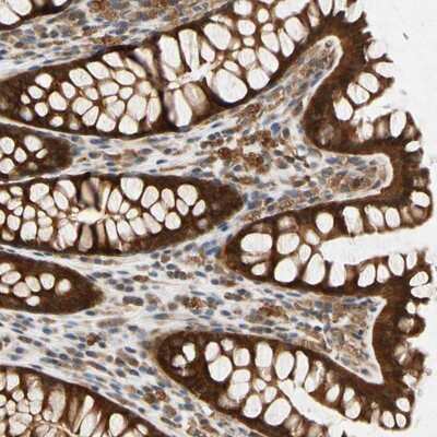 Immunohistochemistry-Paraffin: RSK1 Antibody [NBP1-89647] - Staining of human colon shows strong cytoplasmic positivity in glandular cells.