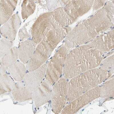 Immunohistochemistry-Paraffin: RSK1 Antibody [NBP1-89647] - Staining of human skeletal muscle shows low expression as expected.