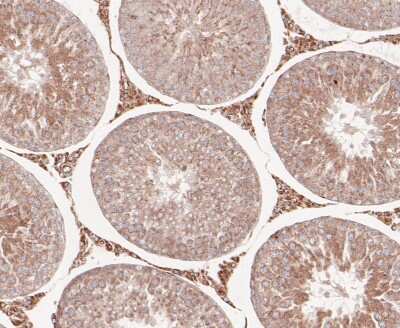 Immunohistochemistry-Paraffin: RSK1 Antibody (JE48-76) [NBP2-80423] - Analysis in rat testis tissue using RSK1 antibody. The section was pre-treated using heat mediated antigen retrieval with sodium citrate buffer (pH 6.0) for 20 minutes. The tissues were blocked in 5% BSA for 30 minutes at room temperature, washed with ddH
