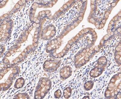 Immunohistochemistry-Paraffin: RSK1 Antibody (JE48-76) [NBP2-80423] - Analysis in human small intestine tissue using RSK1 antibody. The section was pre-treated using heat mediated antigen retrieval with sodium citrate buffer (pH 6.0) for 20 minutes. The tissues were blocked in 5% BSA for 30 minutes at room temperature, wash