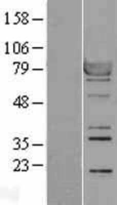 Western Blot: RSK1 Overexpression Lysate (Adult Normal) [NBL1-15570] Left-Empty vector transfected control cell lysate (HEK293 cell lysate); Right -Over-expression Lysate for RSK1.